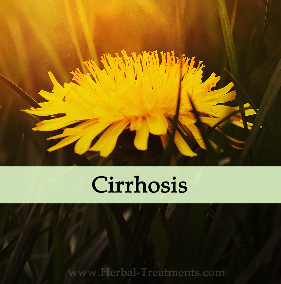 Herbal Medicine for Cirrhosis Avnayt & Waltham's HOLISTIC TREATMENT