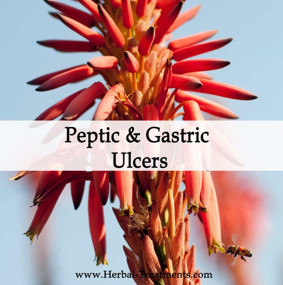 Herbal Medicine for Peptic and Gastric Ulcers Avnayt & Waltham's