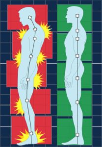 Correct posture